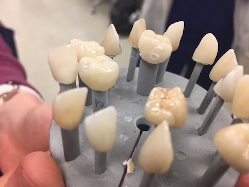 Students and Faculty Received Hands-on Training on Staining of Ceramic Restorations